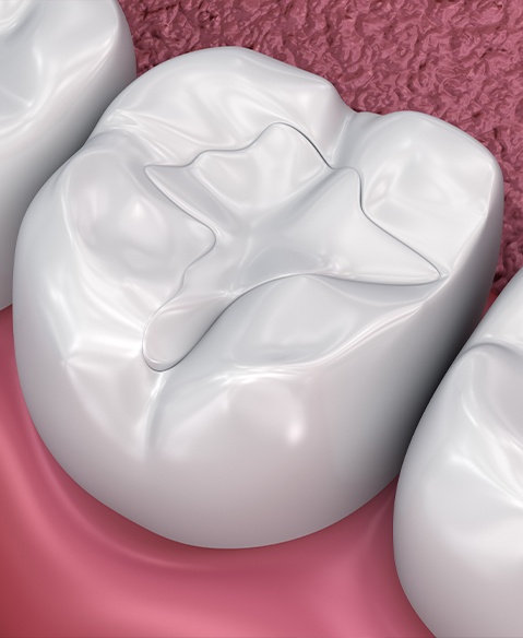 Animated smile with metal free dental restoration