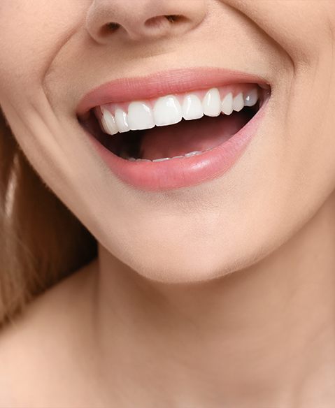 Closeup of beautiful smile after cosmetic dental bonding