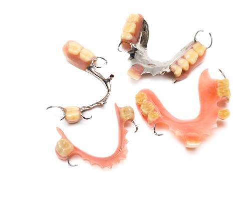 Types of partial dentures in Fayetteville on white background
