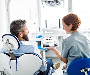 Fayetteville dentist showing dental patient X-ray