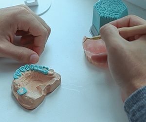 Dentures can be made of many different materials including acrylic