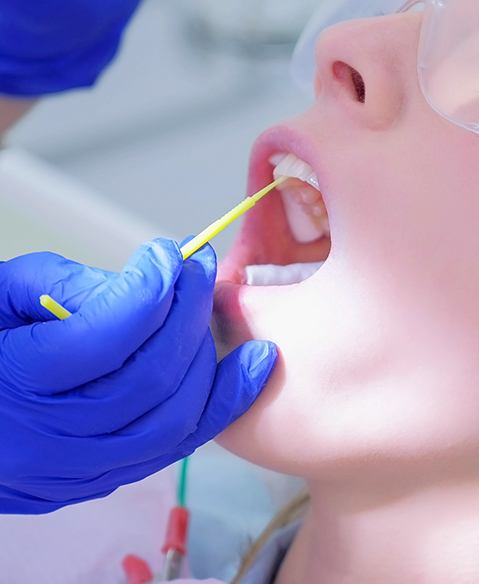 Dental patient receiving fluoride treatment