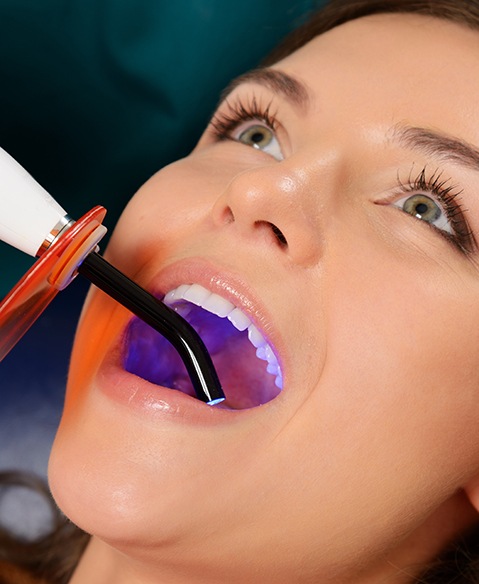 Woman looking up while dentist uses light to harden filling