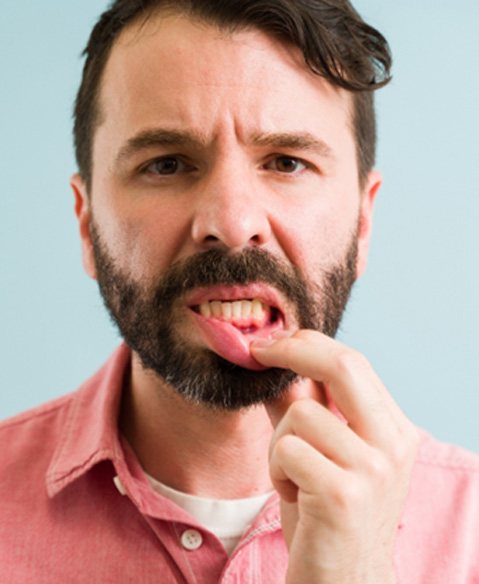 man looking at his gums concerned 