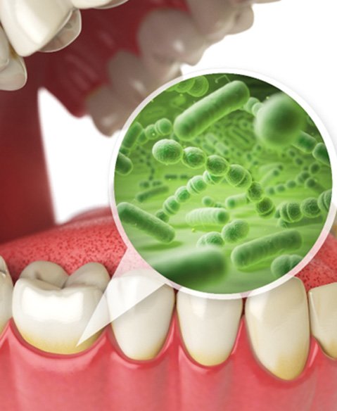 diagram showing oral bacteria    