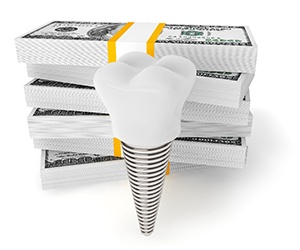 Illustration of a dental implants and money