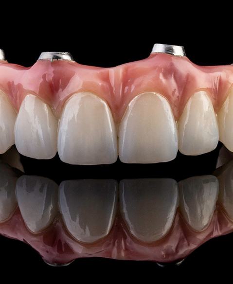 closeup of implant dentures