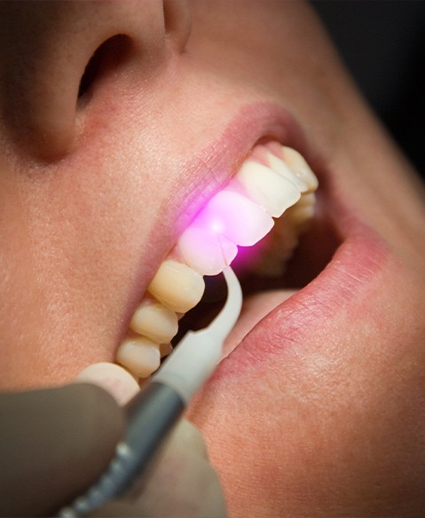 Dental patient receiving soft tissue laser dentistry treatment